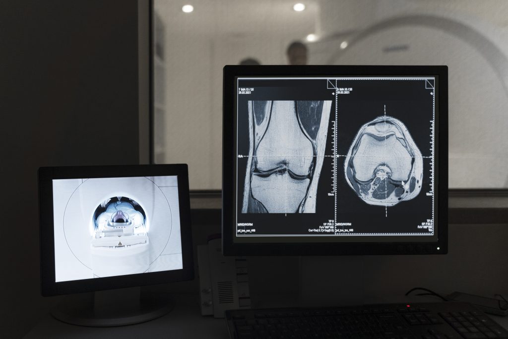 What Are the Benefits of Digital X-Ray?