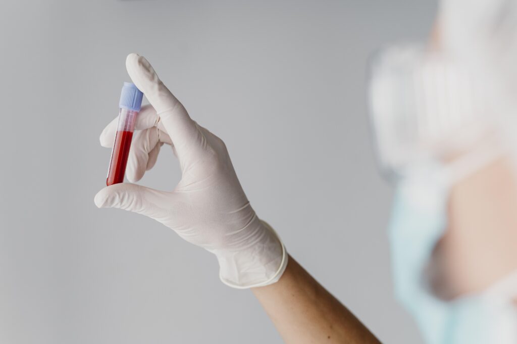 What is the blood test for adrenal function?