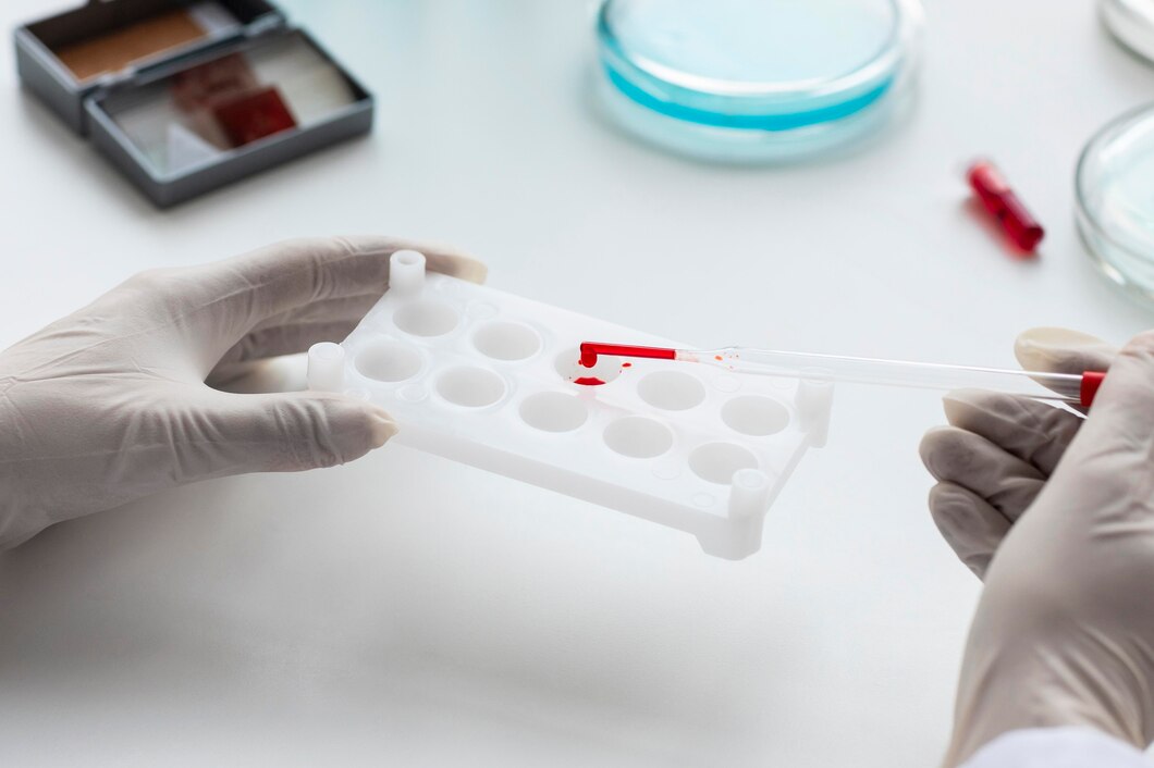 10 Conditions Diagnosed Through Blood Tests